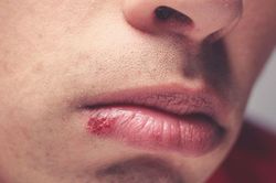 Dấu hiệu trên mặt cảnh báo sức khỏe có vấn đề
