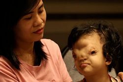 Mẹ của cô bé có khuôn mặt biến dạng ở Quảng Bình gửi con để đi giúp người dân chống lũ
