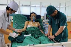 Ho gần nửa lít máu tươi/lần vì u phổi và xơ gan do rượu, bệnh nhân thoát chết ngoạn mục