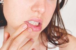 Bảy dấu hiệu của đôi môi hé lộ bệnh tiềm ẩn trong cơ thể