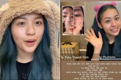 Hot TikToker 'trứng rán cần mỡ' vẫn bị dân mạng nghi ngờ dù đã can đảm công khai mặt mộc