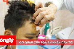 Suýt mất mạng vì bị súng bắn đinh xuyên hộp sọ
