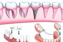 Truyện cười: Biện bạch