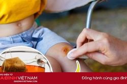 8 công dụng hữu ích của túi lọc trà nhiều người bỏ phí