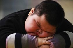 Trẻ béo phì nhưng vẫn thiếu chất