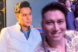 Việt Anh điển trai sau khi lộ gương mặt lạ lẫm hậu phẫu thuật thẩm mỹ
