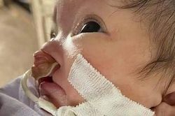 Xin giúp cháu bé vừa chào đời đã mắc bệnh hiểm nghèo!