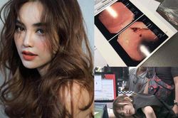 Suýt không thể sinh con vì ung thư, Ninh Dương Lan Ngọc còn từng bị loét và chảy máu dạ dày