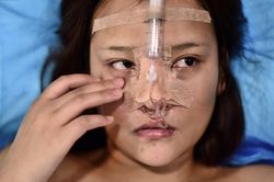 Nhiều bạn trẻ ở Trung Quốc vay nợ để tân trang nhan sắc