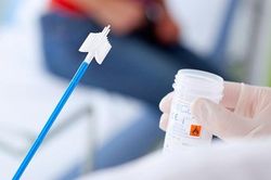 Điều ít biết về quy trình tầm soát ung thư cổ tử cung
