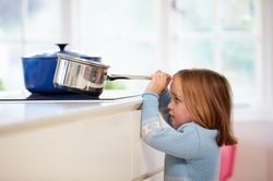 Trẻ một tuổi bị bỏng nặng do nghịch bát mì tôm