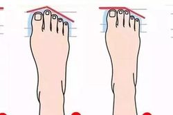 Sở hữu tướng bàn chân này, hậu vận sẽ giàu sang