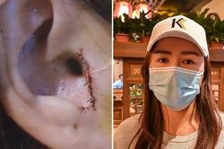 Phẫu thuật nâng mũi, cô gái 'chết đứng người' khi phát hiện sự thật