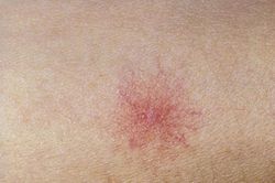 Có dấu hiệu này, đi khám ngay kẻo hại gan khó cứu vãn