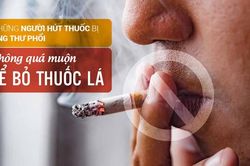 Hút thuốc lá gây ung thư