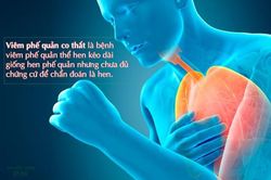 Viêm phế quản co thắt là gì? Nguyên nhân, triệu chứng, cách điều trị