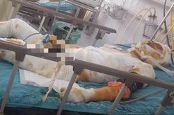 Cha bỏng nặng 99% nguy kịch, con thơ ngơ ngác đợi chờ