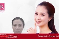 U40 hack 10 tuổi nhờ công nghệ làm đẹp căng chỉ Be- Young