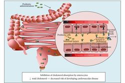 Lactobacillus plantarum hỗ trợ giảm mỡ máu, giảm nguy cơ xơ vữa động mạch
