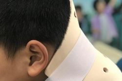 Bắt chước trò nhào lộn trên Tiktok, bé trai chấn thương cột sống cổ