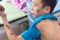 Nhân viên 15 tuổi kể chuỗi ngày bị chủ quán bánh xèo tra tấn: Nằm ngủ nền đất, ăn đồ thừa của khách
