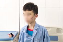 Nhân viên 15 tuổi bị chủ quán bánh xèo đánh đập dã man: 'Em kể với anh trai nhưng lại bị anh chửi'