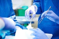 Người đàn ông có quả thận to như trái dừa vì sỏi tắc nghẽn lâu ngày
