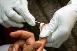 Thế nào là phơi nhiễm HIV?