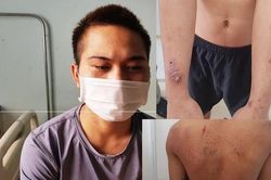 Chủ quán bạo hành nhân viên: Chủ cầm dao đánh bị thương, cấm không đi viện