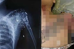 Kẻ nã súng như phim 'xã hội đen' vào nam thanh niên ở Thái Bình ra đầu thú