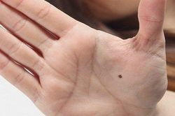 Vị trí nốt ruồi vàng để chị em phụ nữ giàu cả đời