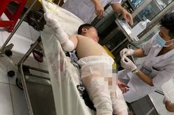 Xin cứu 2 cháu bé bị cha ruột tẩm xăng thiêu sống, bỏng nặng!