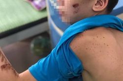 Hội Bảo vệ quyền trẻ em lên tiếng vụ chủ quán bánh xèo bạo hành nhân viên