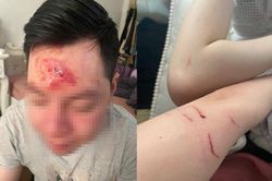 Mời rượu không uống, nhân viên quán bar xông vào đánh khách rách trán