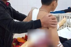 Không kịp hãm phanh do phóng xe với tốc độ cao, nam sinh bị cây keo dài gần 2m đâm xuyên người