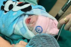 Ca mổ bắt con trong tư thế ngồi cho người mẹ mắc ung thư