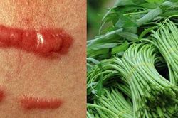 5 đại kỵ khi ăn rau muống gây ngộ độc, hại thận