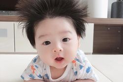 Tóc trẻ sơ sinh mọc dựng đứng kèm theo biểu hiện này cần đi khám bác sĩ