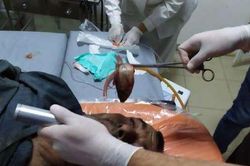 Tai nạn kỳ lạ khiến người đàn ông bị cá sống mắc kẹt trong cổ họng