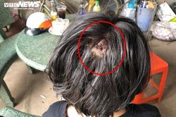 Nữ sinh bị tên côn đồ đạp liên tiếp vào mặt: 'Con sợ không ngủ được'