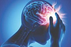 Đột quỵ: Nguyên nhân là gì, cách phòng tránh thế nào?