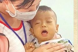 Gia cảnh thương tâm của bé trai 15 tháng tuổi chờ được ghép gan