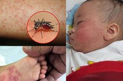 TPHCM: Bệnh sốt xuất huyết, tay chân miệng và sởi giảm