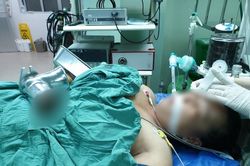 Người phụ nữ bị xay nát cả bàn tay trong máy làm chả cá