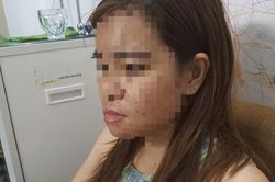 Người phụ nữ bị đánh hội đồng gãy quai hàm ngay tại nhà ở Bình Dương