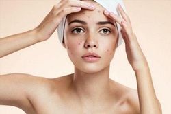 Những thói quen xấu khiến da mụn ngày càng trở nên tệ hại