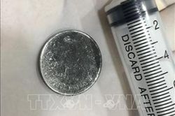 Cấp cứu kịp thời bé gái 4 tuổi nuốt phải đồng xu trong lúc chơi đùa