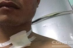 Tài xế xe ôm chở khách từ Sài Gòn về Bình Dương, bị đâm trọng thương, cướp xe
