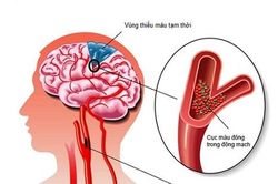 Cảnh báo các vấn đề sức khỏe do thời tiết lạnh