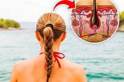 4 kiểu tóc dễ gây ra cơn đau đầu
